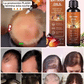 🌿50% OFF NOW! Batana Oil Hair Growth Serum – Nourishing Scalp Care Oil with Rosemary & Castor Oil, Strengthen Follicles & Reduce Hair Loss