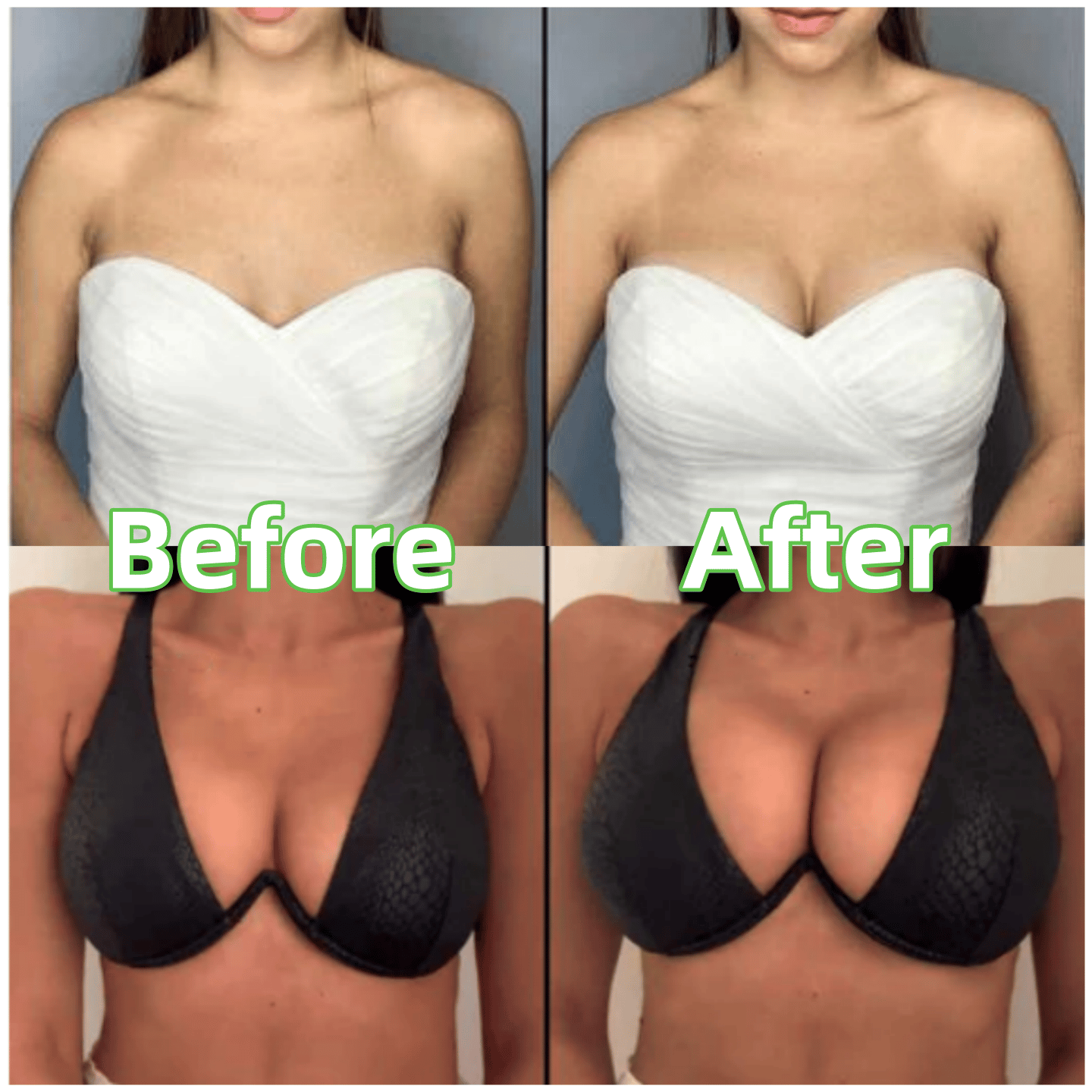🎉BUY 1 GET 1 FREE🎉Ultra Boost Inserts || Patented Sticky Fashion Bra Inserts