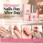 💅Limited Time Buy 1 Get 1 FREE！✨3-in-1 Nail Strengthener Treatment, Repair Serum for Weak Soft Cracked Nails, Smooth Shiny Nail Hardener for Damaged Nails