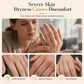 🧴50% OFF NOW! Deep Hydrolyzed Collagen Hand Cream – Non-Greasy Moisturizing Hand Lotion, Hydrating Repair Cream for Dry Cracked Hands, 30g Travel Size Hand Care